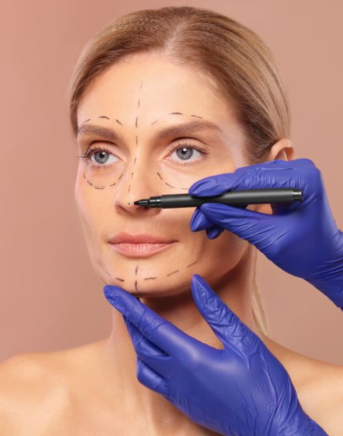 Rinomodelacion con hilos tensores en Madrid